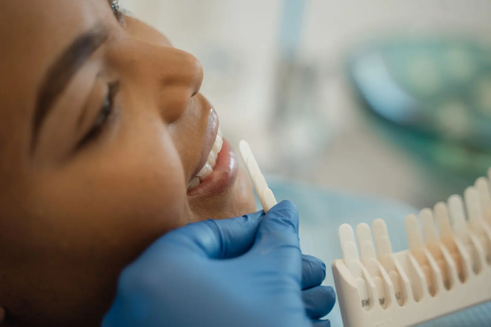 Dentista comparando a cor dos dentes da paciente com a escala de cores antes do clareamento dental