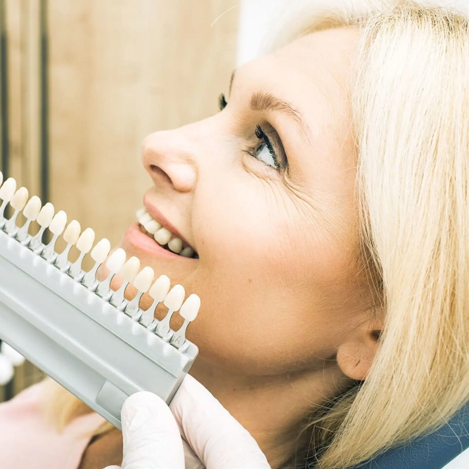 Dentista conferindo a cor dos dentes com a escala no planejamento das facetas em resina